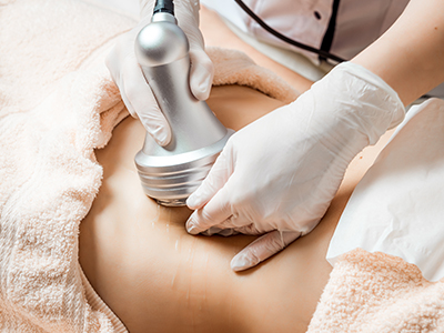 Why Women Hair Transplant